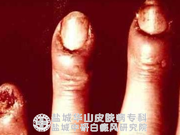 å•å‡»å3-„ˆ