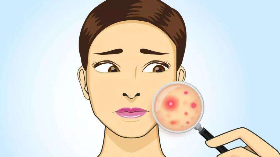 �γǻ�ɽƤ����ר�ƣ��γǰ����о�Ժ��