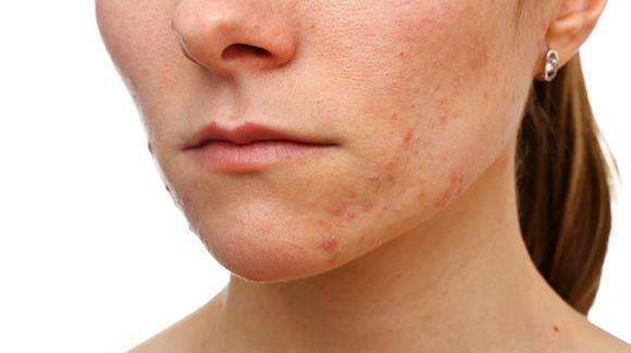 �γǻ�ɽƤ����ר��