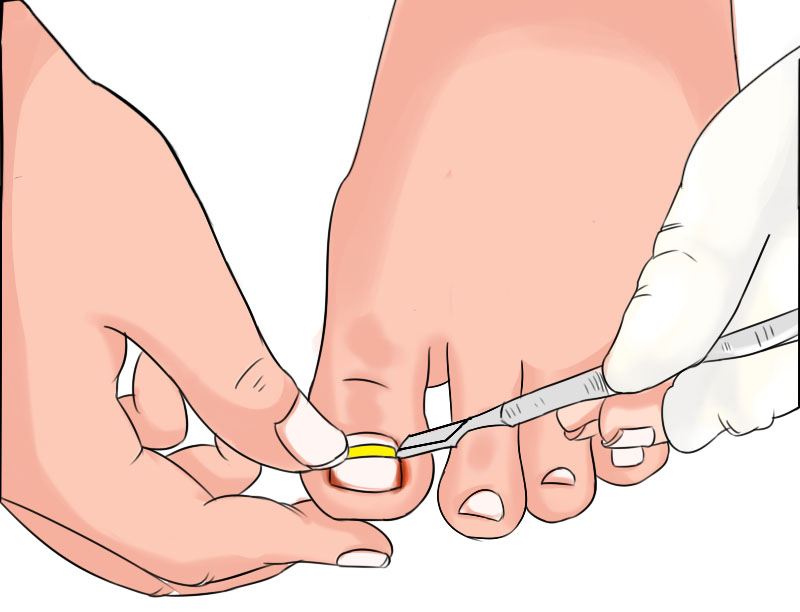 �γǻ�ɽƤ����ר��