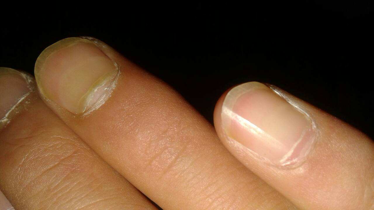 �������롪�������ָ�׿�����