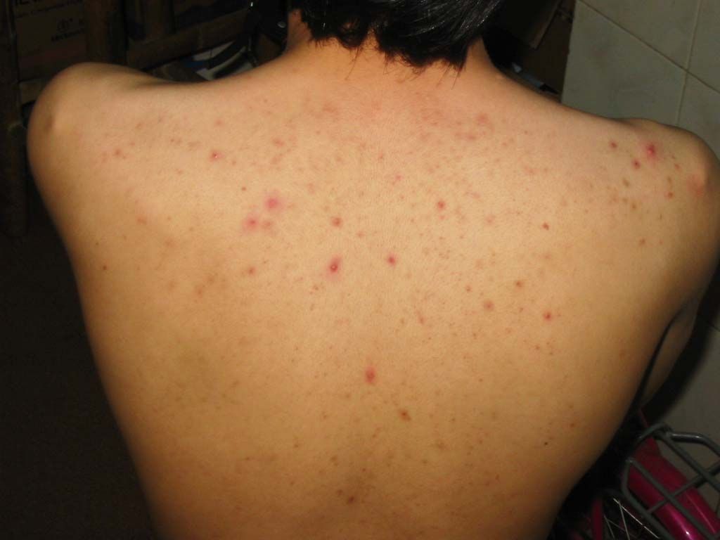 �γǻ�ɽƤ����ר��