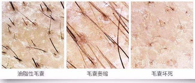 �γǻ�ɽƤ����ר��