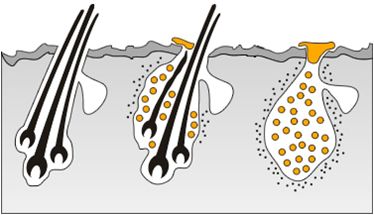 �γǻ�ɽƤ����ר��